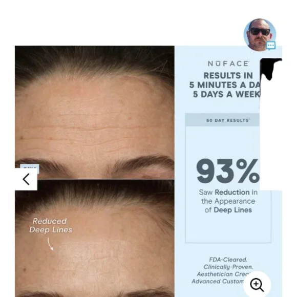 NuFace Effective Lip & Eye Attachment for Trinity+ Microcurrent Device *NEW - Picture 4 of 4